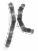 Human male karyotpe high resolution - Chromosome 3 cropped.png