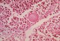 Mature spherule with endospores of Coccidioides immitis PHIL 480 lores.jpg