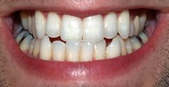 Teeth by David Shankbone.jpg
