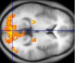 Images of the brain recorded with PET (top) and fMRI (bottom). The red areas and the orange areas, respectively, are the most active in these recordings.