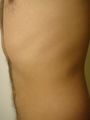 Side view of human rib cage. Seen are the 5-12 spareribs under lean muscle.
