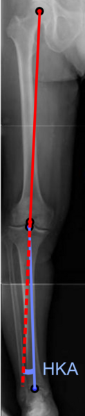 ملف:Hip-knee-ankle angle.png