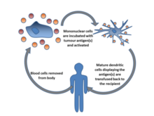 Blood cells are removed from the body, incubated with tumour antigen(s) and activated. Mature dendritic cells are then returned to the original cancer-bearing donor to induce an immune response. Blood cells are removed from the body, incubated with tumour antigen(s) and activated. Mature dendritic cells are then returned to the original cancer-bearing donor to induce an immune response.