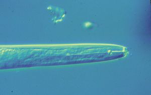 Pratylenchus.jpg