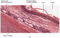 Cross-section of the trachea, with pseudostratified ciliated columnar epithelium and goblet cells labelled