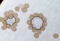 Pustules of urediniospores.