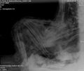 The foot area is broken. The lower section of the thoracic cavity appears to have been eviscerated, and some bandages were introduced into the body.[22]