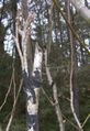 Successful stub graft, healed