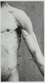 Braus 1921 163.png
