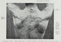 Braus 1921 133.png
