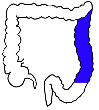 ColonDiscendente.png