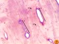 Bone by decalcification (100x): Volkmann's canal Haversian canal lamella Lacuna