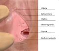 A picture of a human vulva, showing the entrance to the vagina.