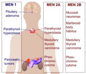 Multiple endocrine neoplasia.png