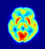 Images of the brain recorded with PET (top) and fMRI (bottom). The red areas and the orange areas, respectively, are the most active in these recordings.