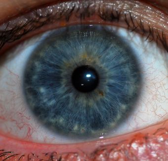 Human Iris JD052007.jpg