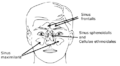 Lateral wall of nasal cavity, showing ethmoid bone in position.
