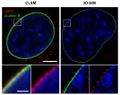 Comparison confocal microscopy – 3D-SIM