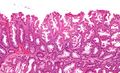 Intermediate magnification micrograph of a SSA.