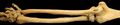 Right posterior human radius and ulna
